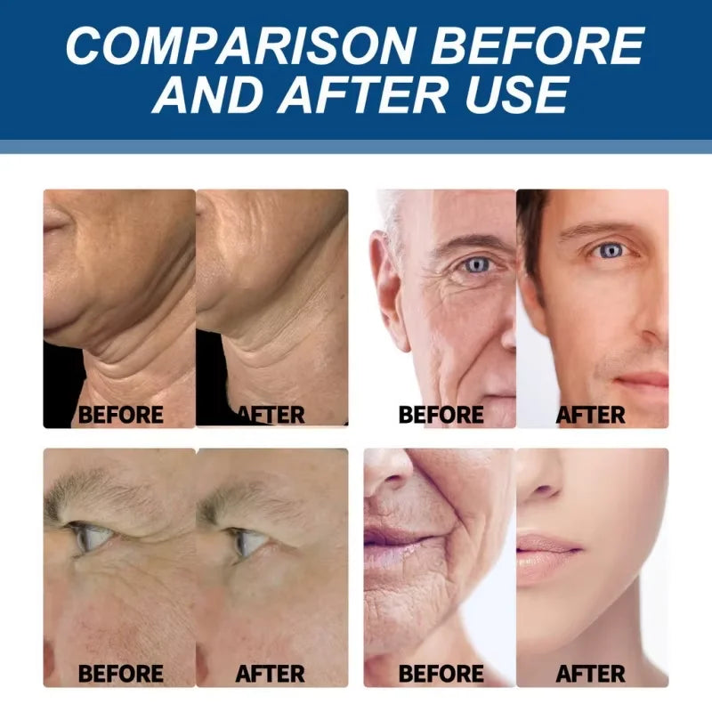 Men's Wrinkle Fighter Cream