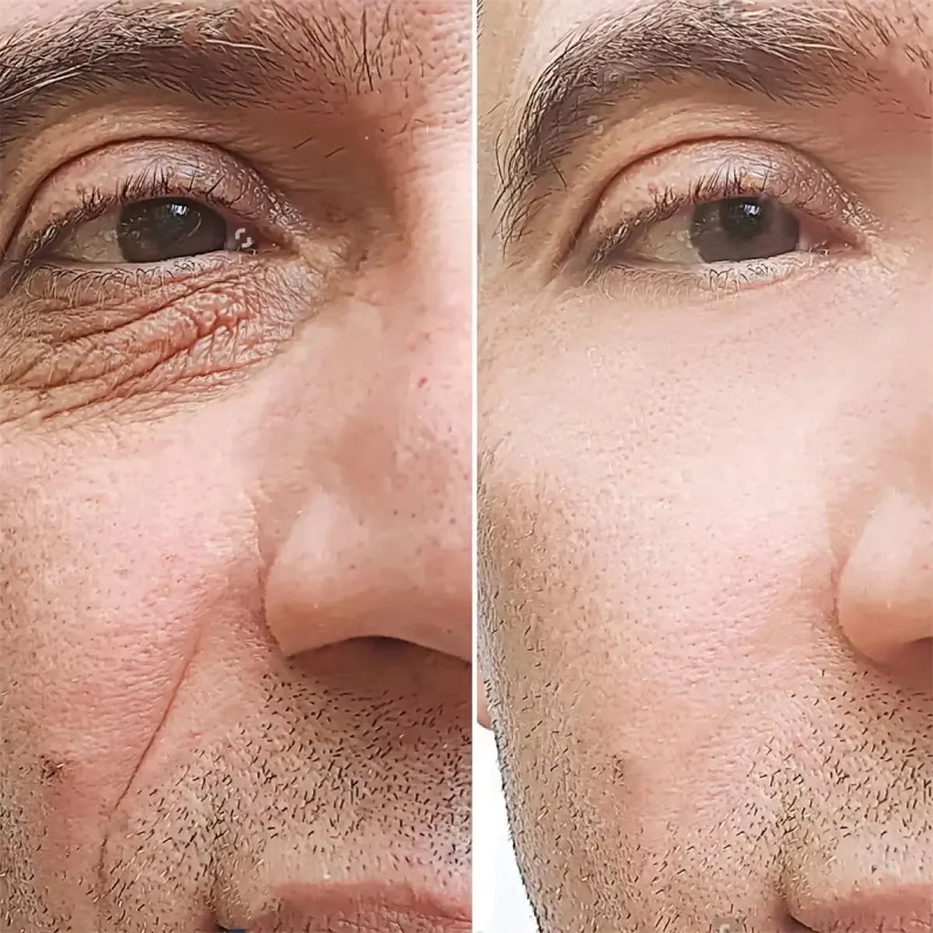 Men's Wrinkle Fighter Cream