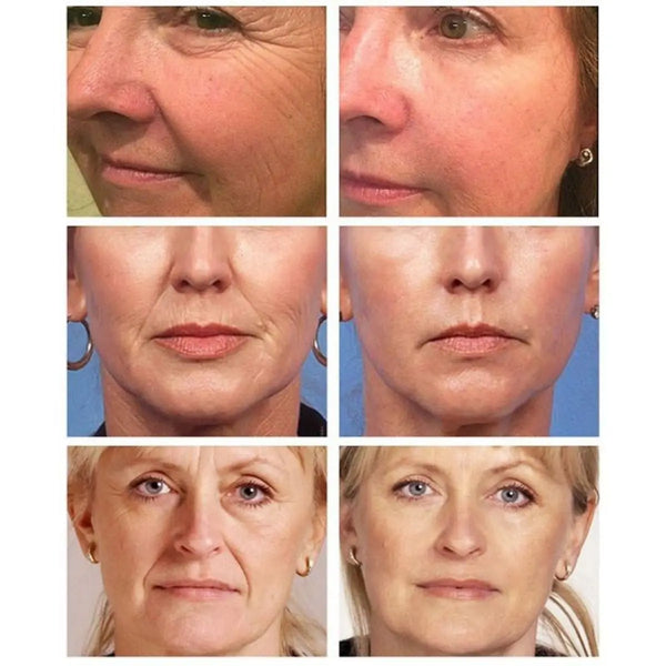 Radiant Glow Retinol Cream