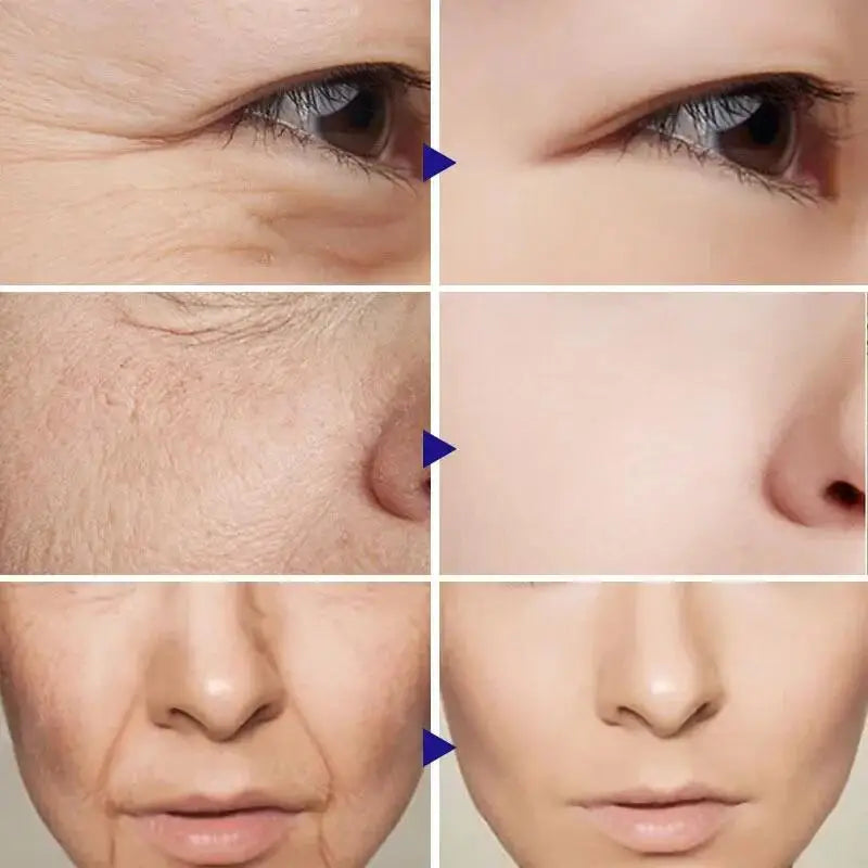 Wrinkle Boss Serum Set